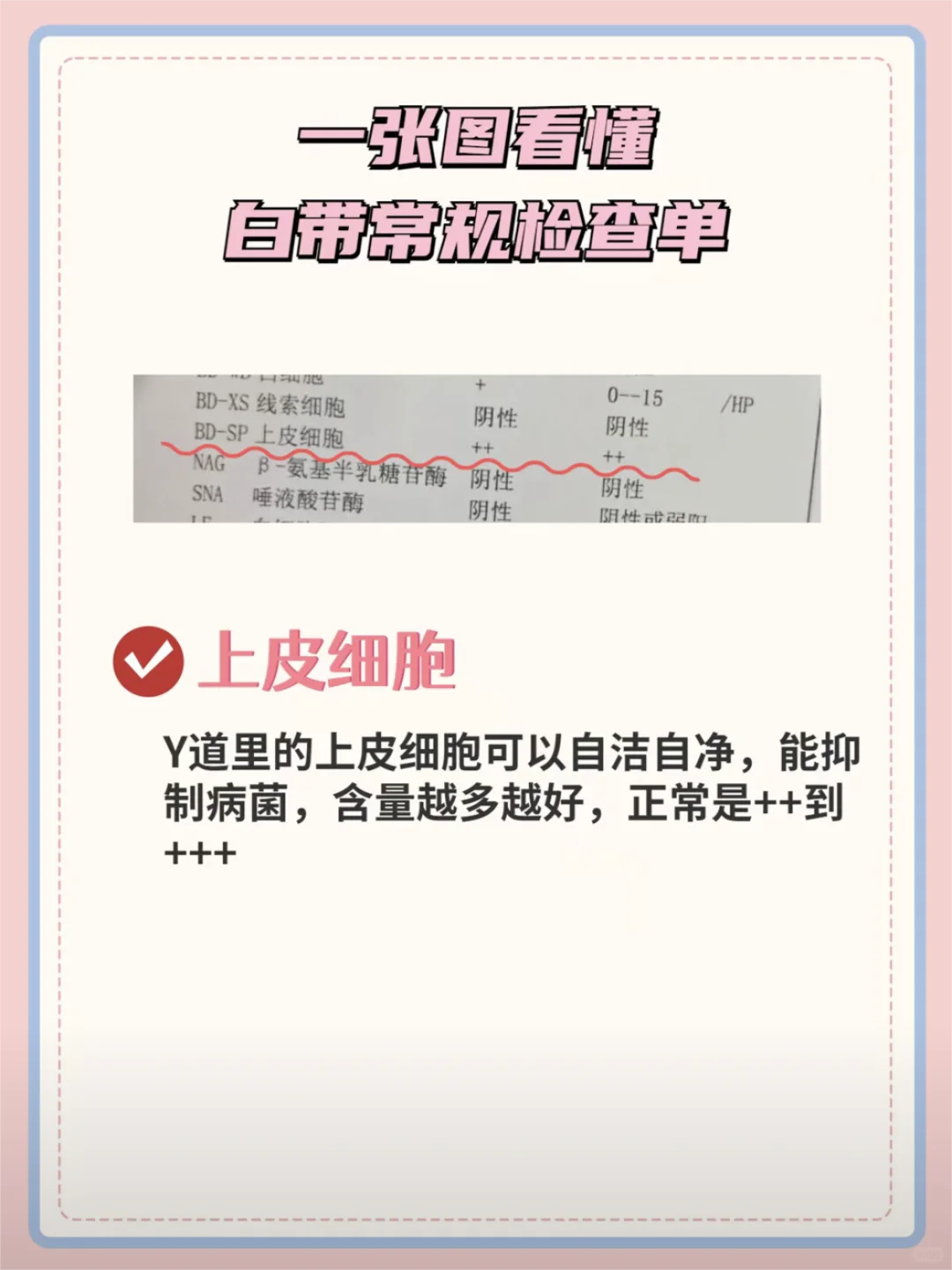 妇科医生教你一张图看懂白带常规检查单