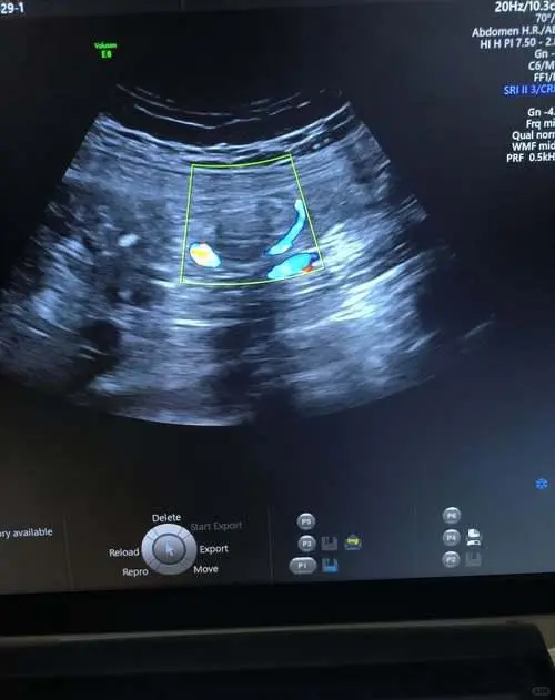 别再被体检套餐“套路”！每年体检该查什么