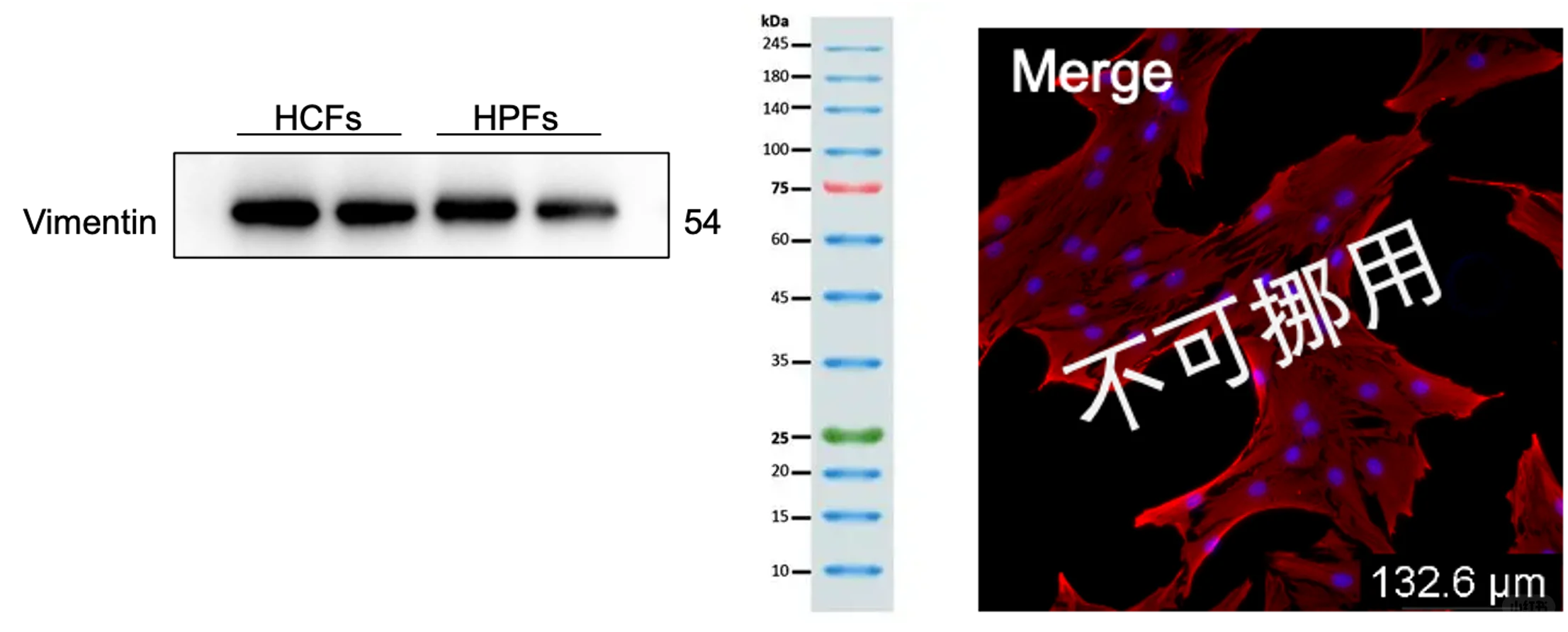 Vimentin免疫荧光和WB！科研小乞丐来还愿