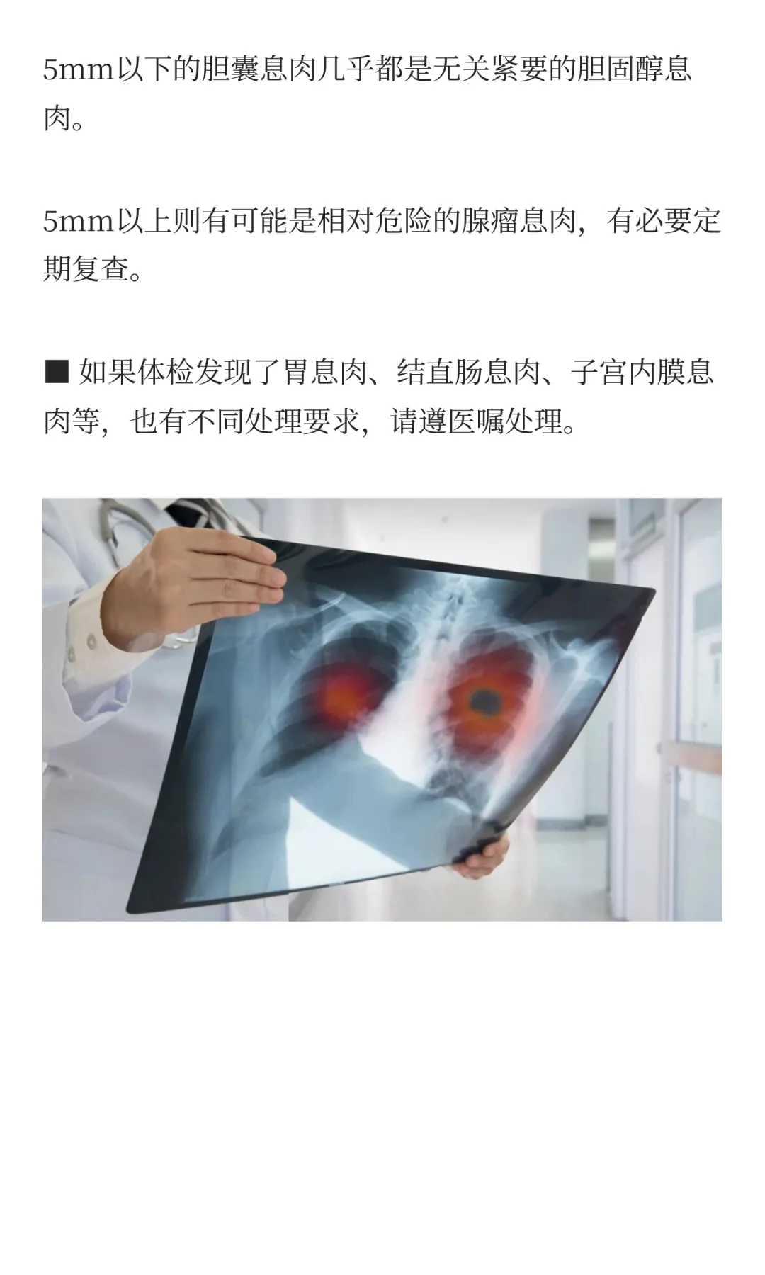 帮你读懂体检报告单上的这些指标异常