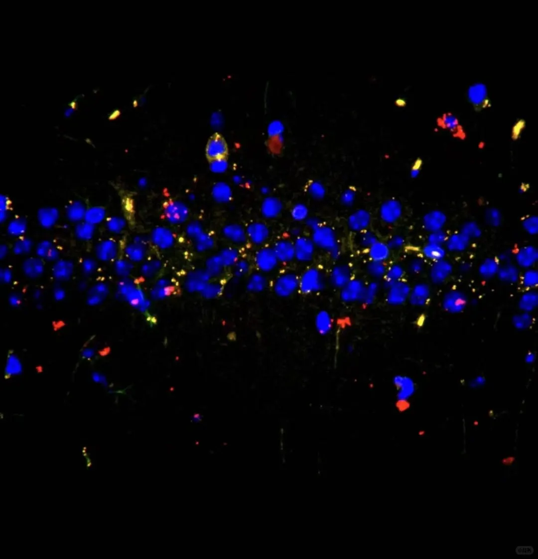 超详细免疫荧光实验教程(新手必存!)