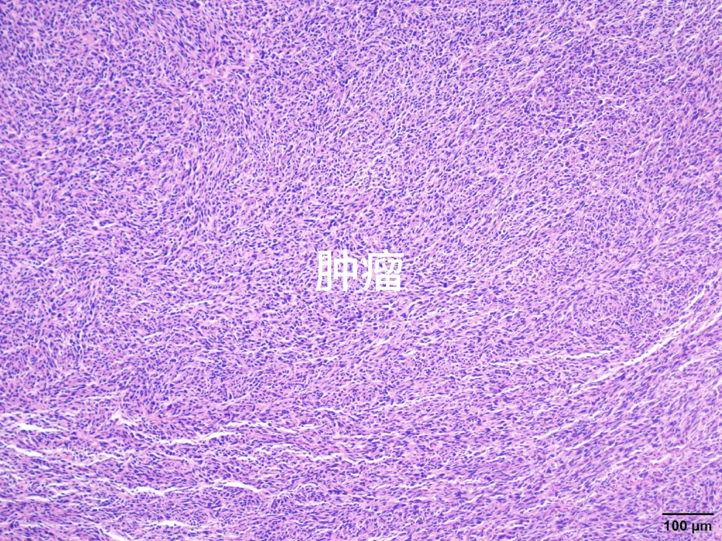 心肝脾肺肾肿瘤HE染色