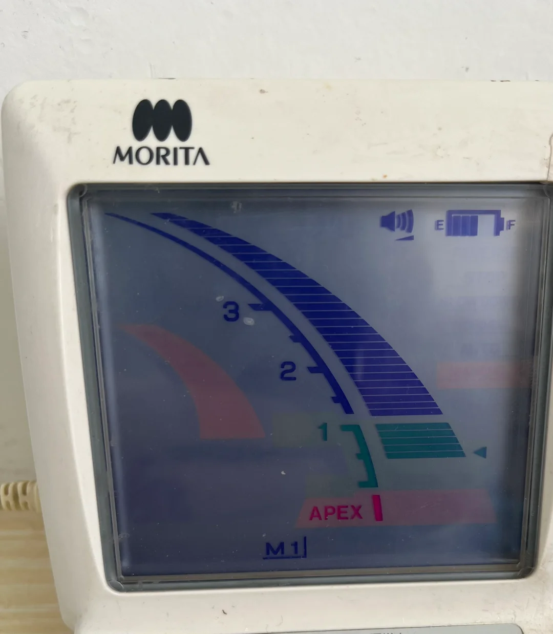 根管治疗之，9年的森田根测仪