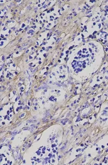 免疫组化染色步骤