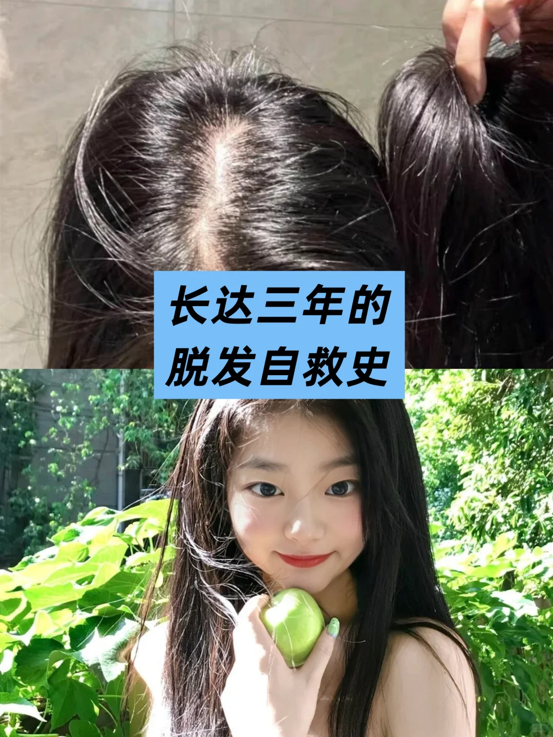 长达三年的脱发自救史