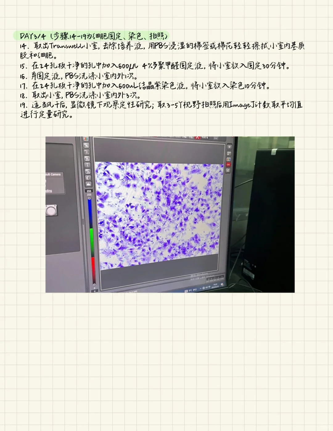 Transwell实验一次性通关!保姆级教程?
