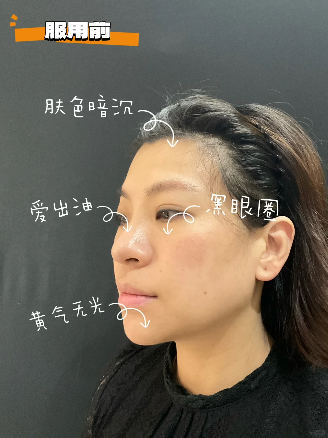 职场宝妈熬夜垮脸?介颗“抗老小粉丸”?大命