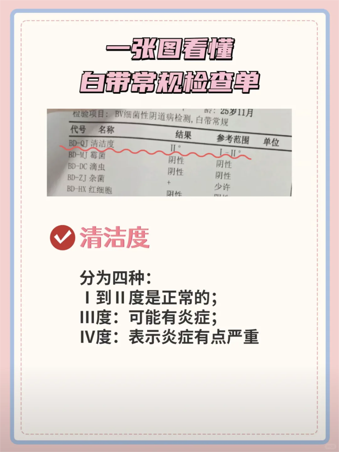 妇科医生教你一张图看懂白带常规检查单