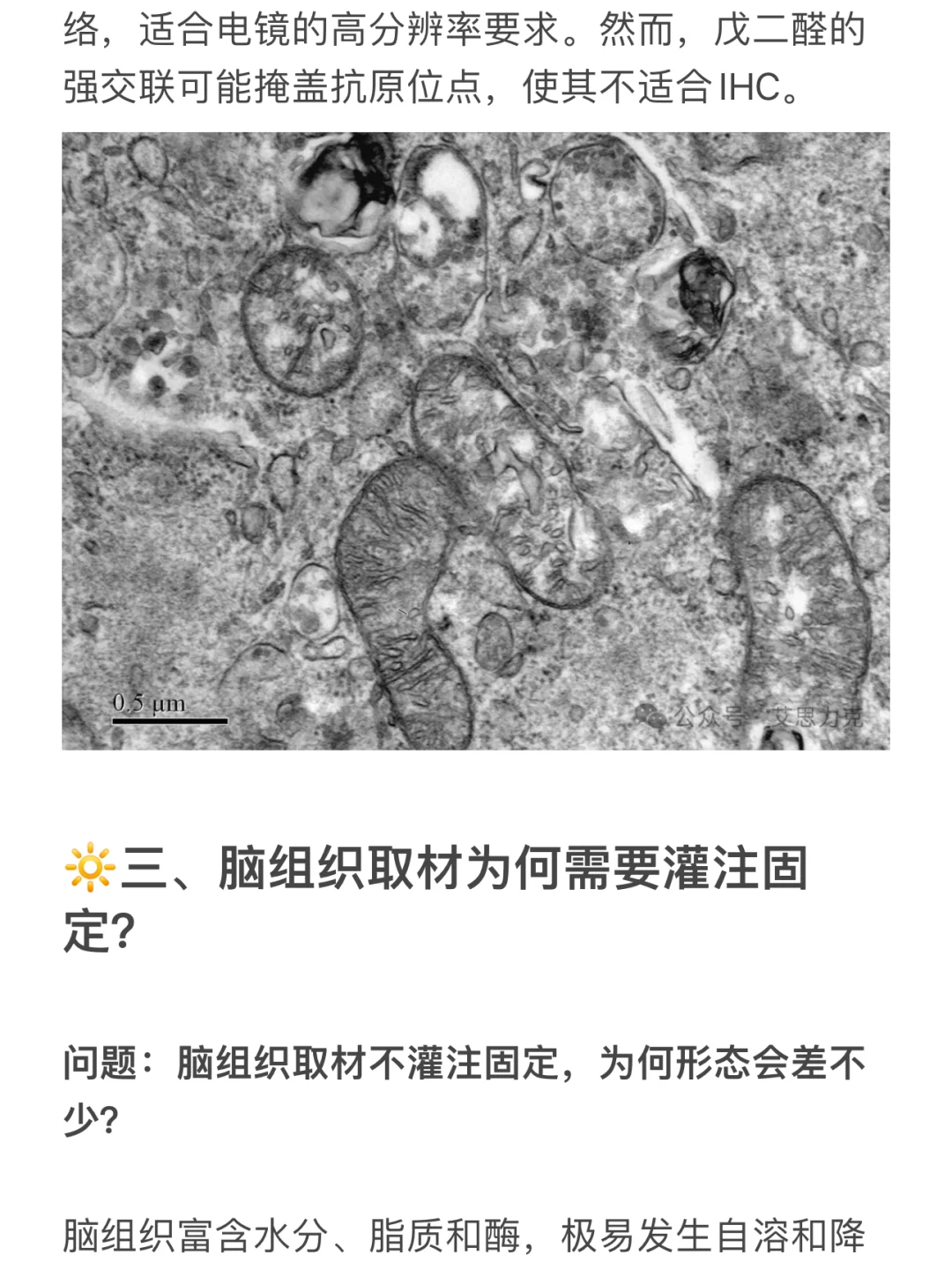 固定液怎么选❓多酚醛甲基和戊二醛的区别