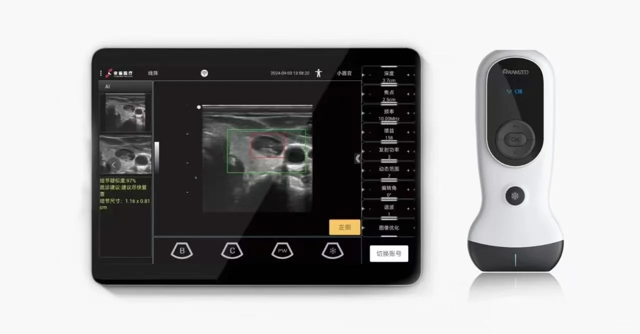 AI掌超的商业模式分享
