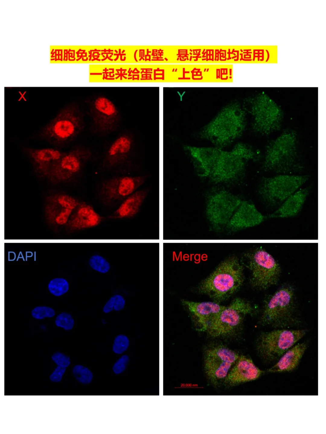 保姆级免疫荧光实验protocol~