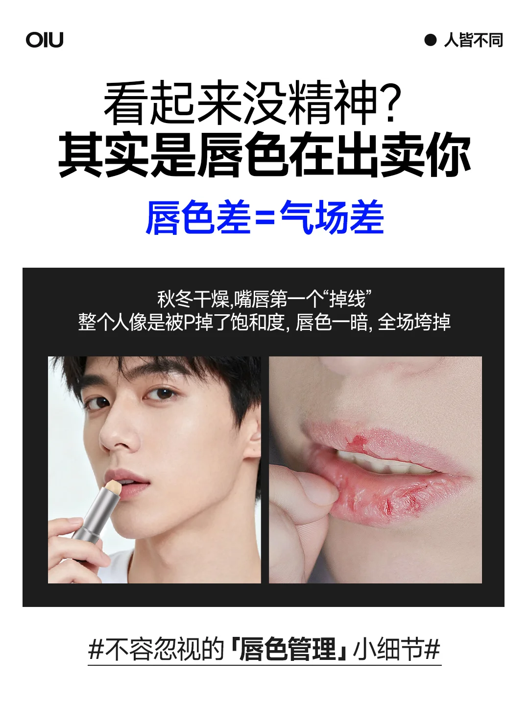 秋冬男生气色管理｜OIU植润护唇膏上新啦！