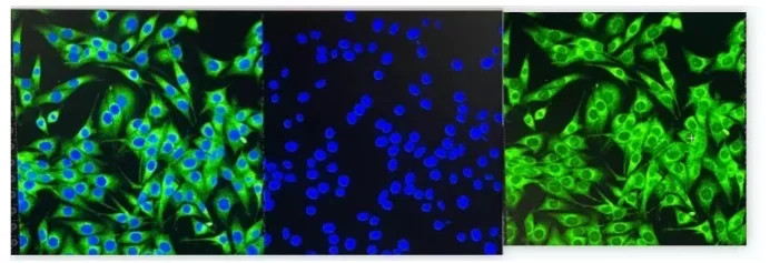 免疫荧光染色实验步骤?