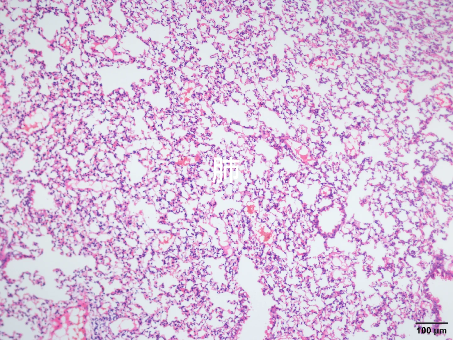 心肝脾肺肾肿瘤HE染色