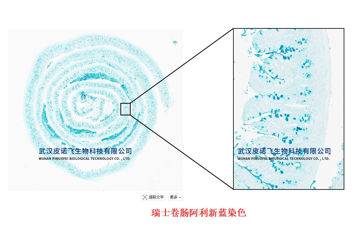 小鼠肠道#瑞士卷肠制作+肠道常见染色效果图
