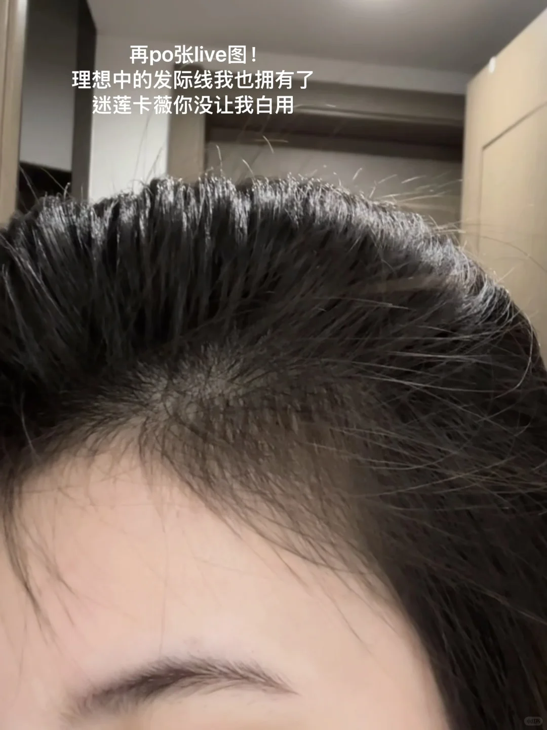 关于防脱固发…我有话说！！！