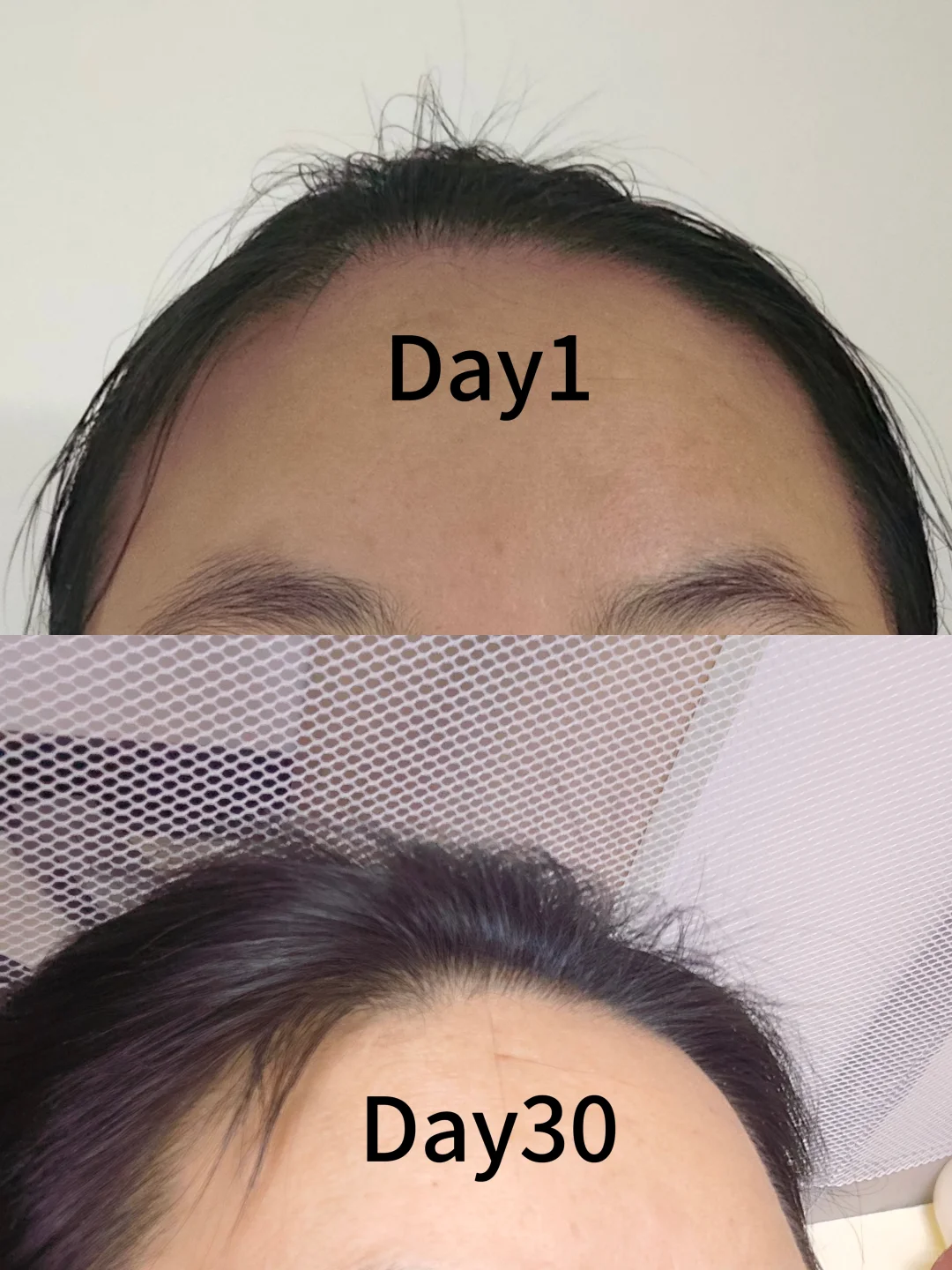 喝胶原蛋白肽本来是想皮肤变好的，没想到…