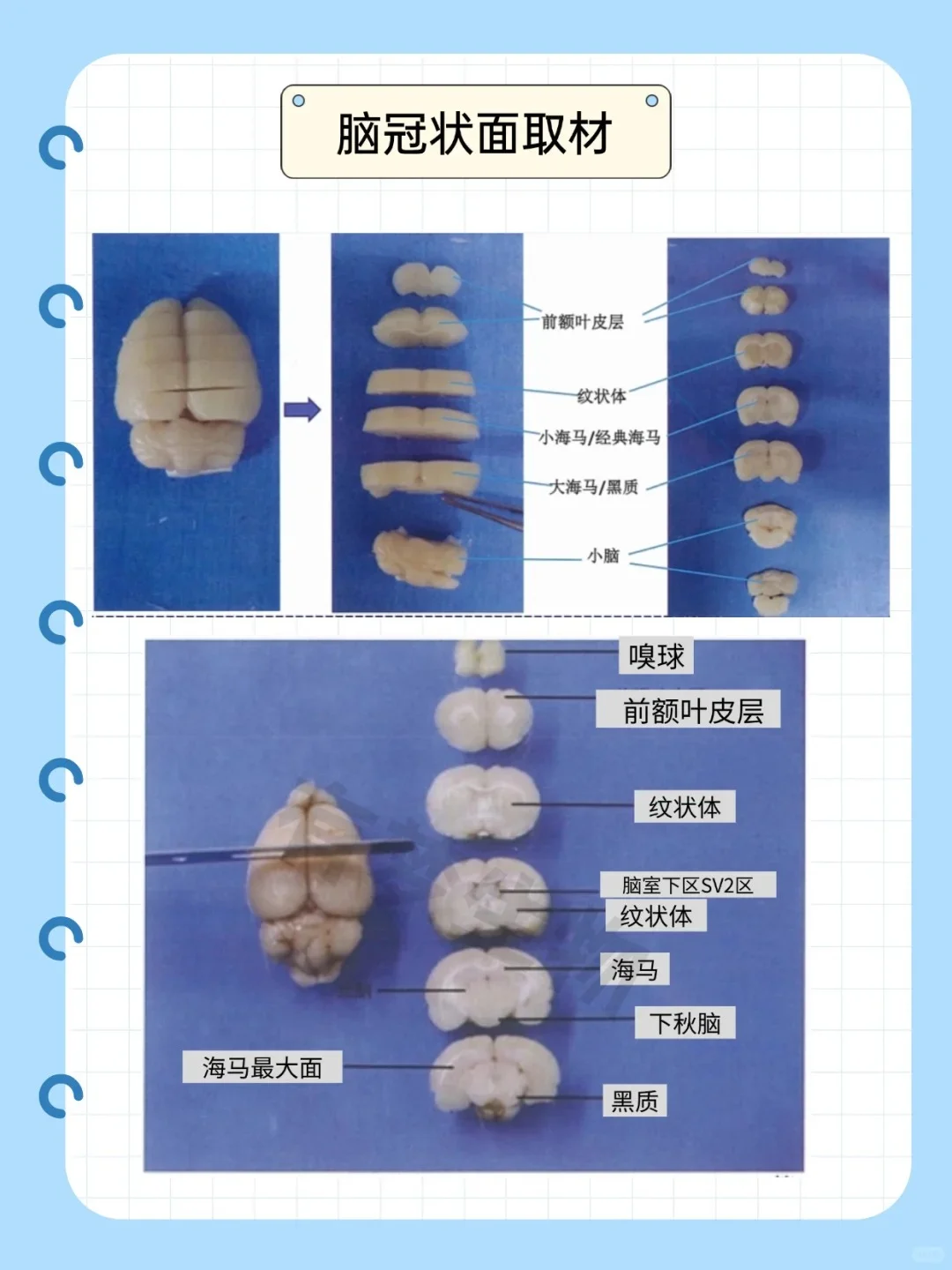 脑科学解剖指南｜三维切面解析