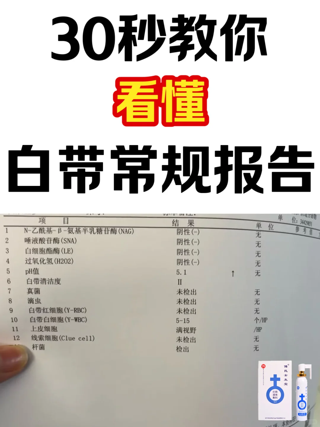 白带常规检查报告，一看就懂！