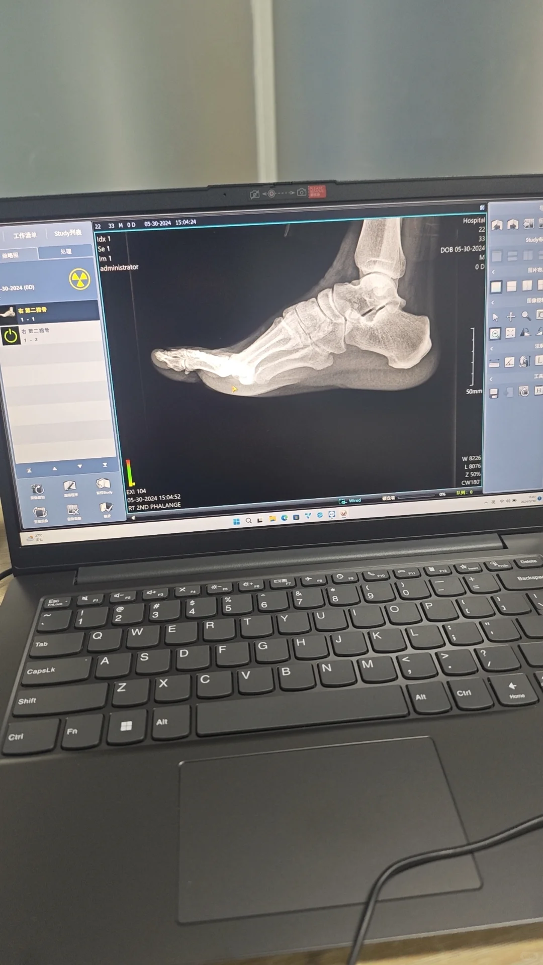 开始打窝子，钓几个小白来学医疗设备维修