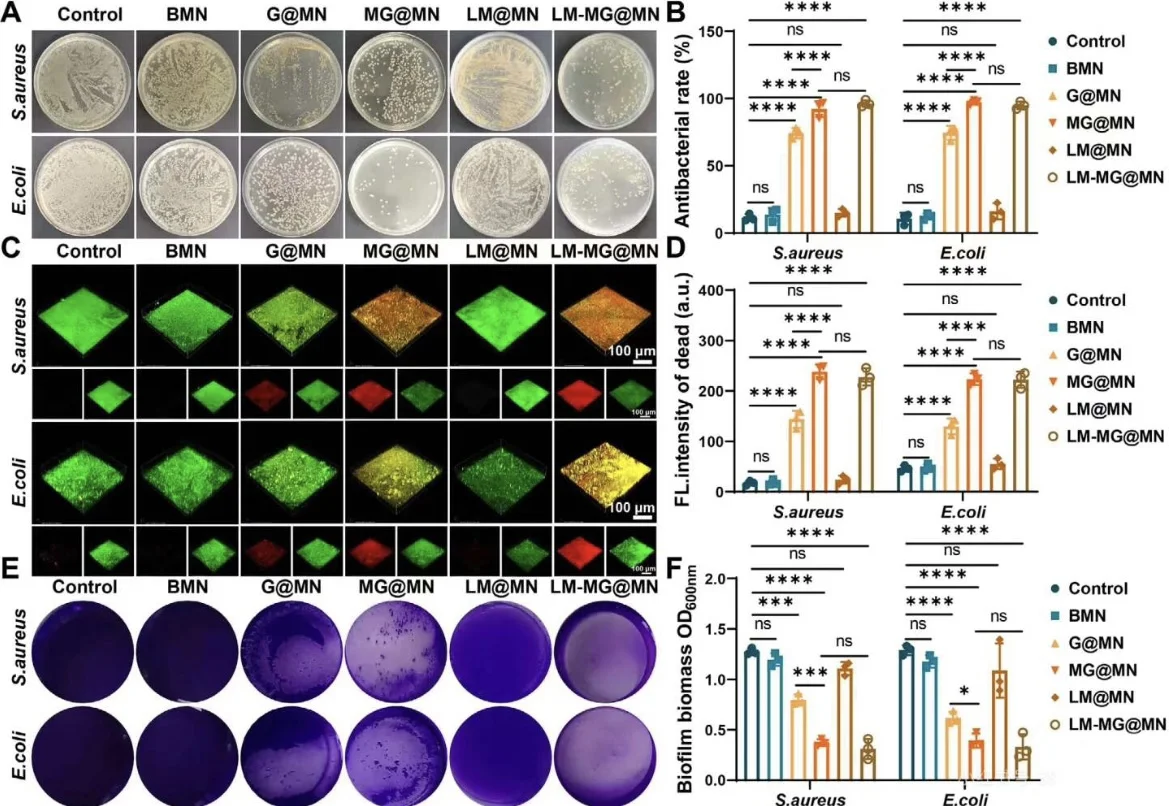 有趣的抗菌实验❗❗❗