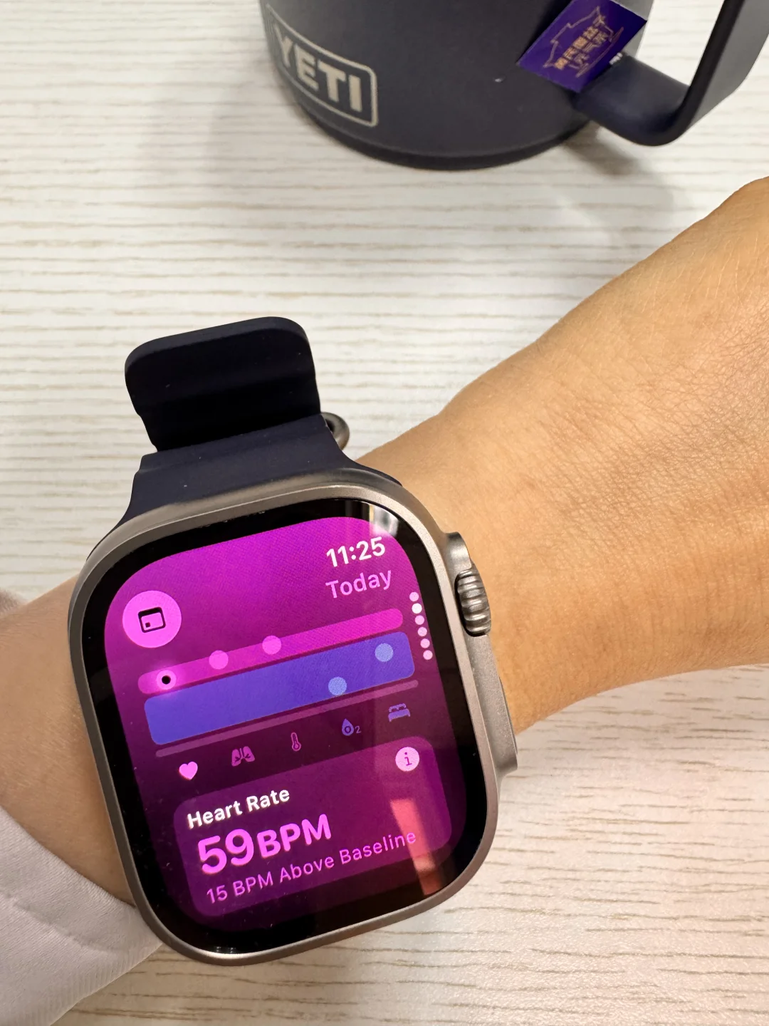 自从发现我发烧了，我的手表很怕我噶了