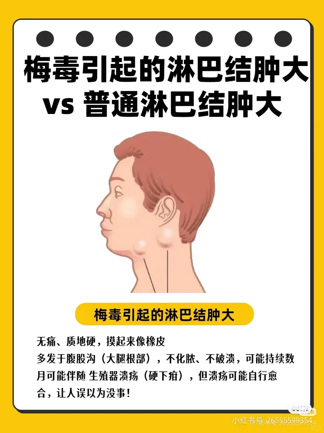 熬夜后淋巴结肿大？小心梅毒悄悄入侵！