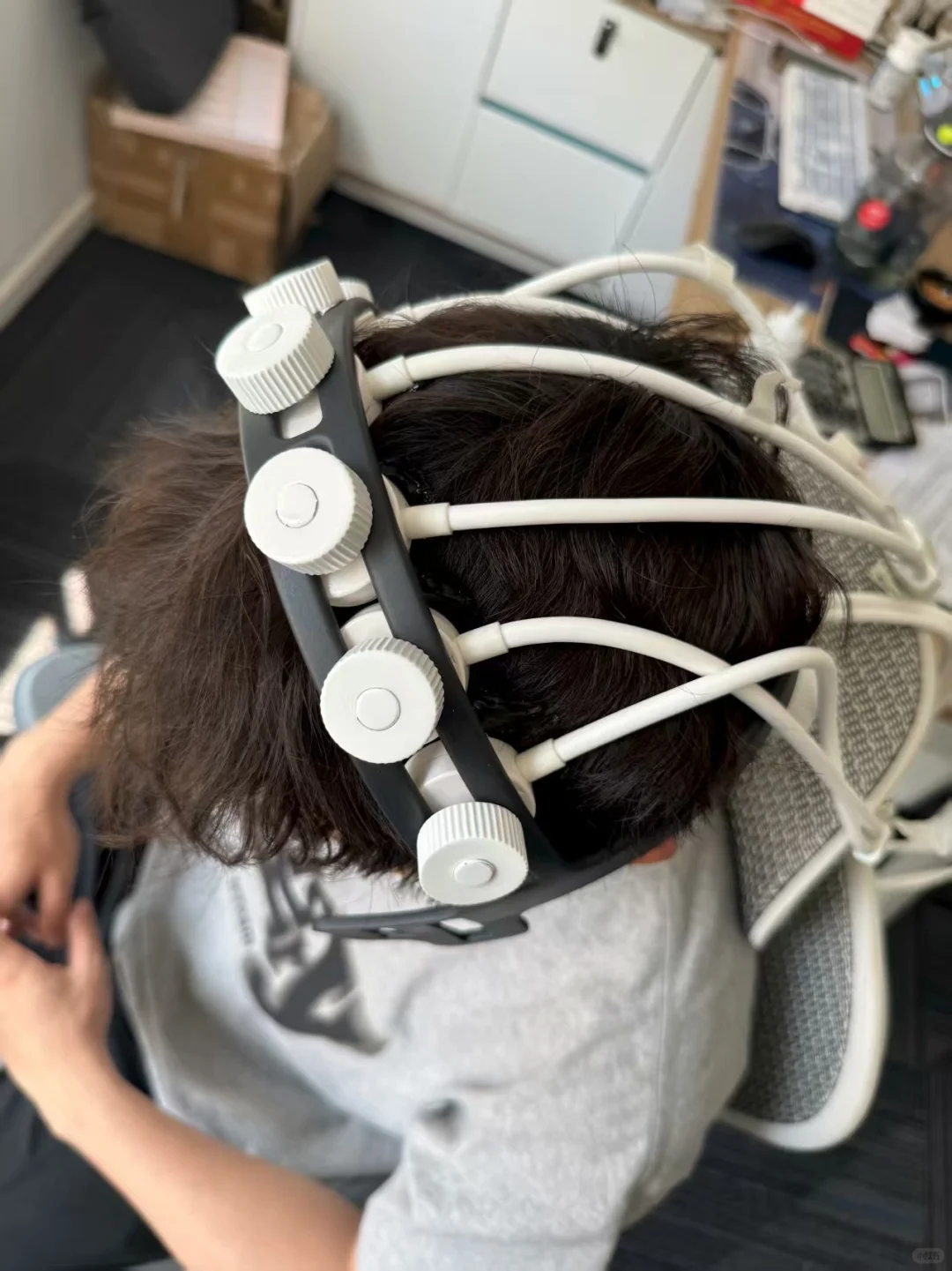 超声脑机接口!!优势和不足