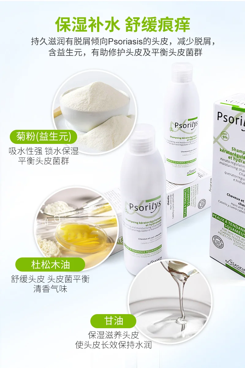 ?头皮银屑病，困扰何时休？