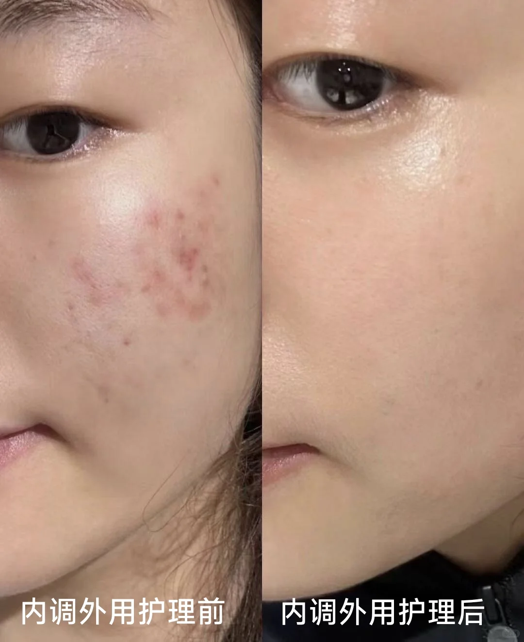 口服胶原蛋白是不是智商税？