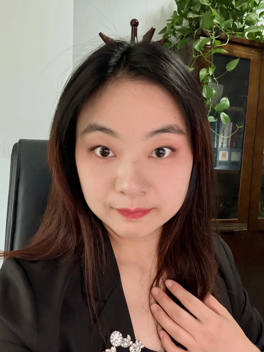 泪沟凹陷打了一支胶原蛋白，效果确实不一样