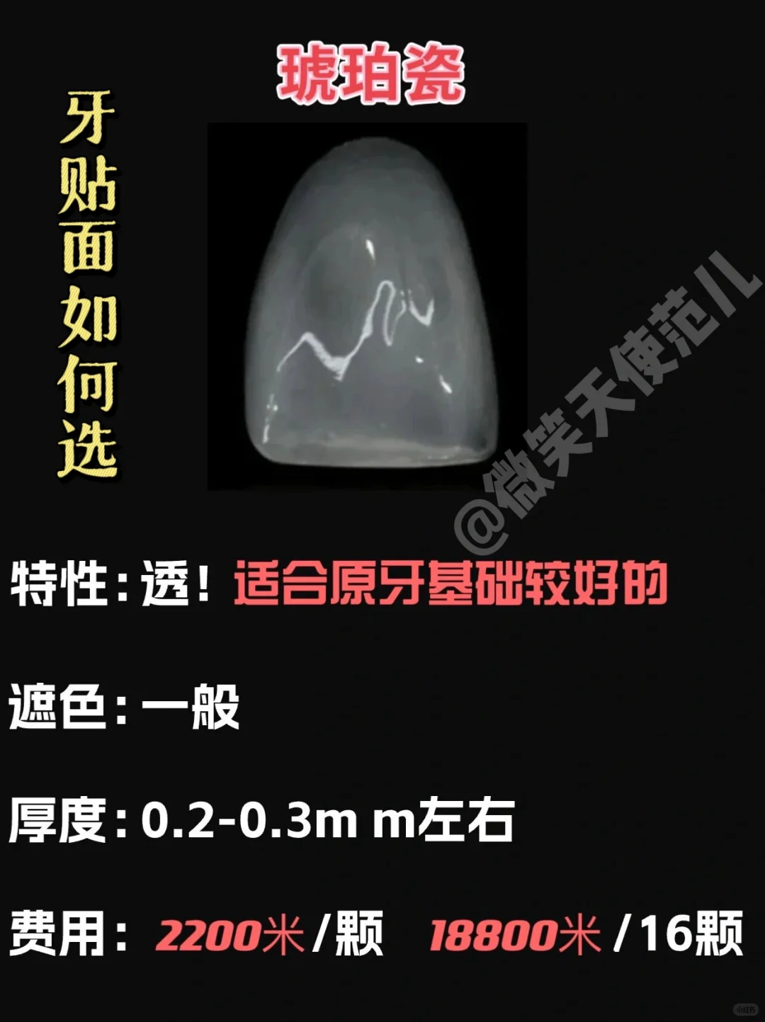 全瓷贴面都是有哪几种?