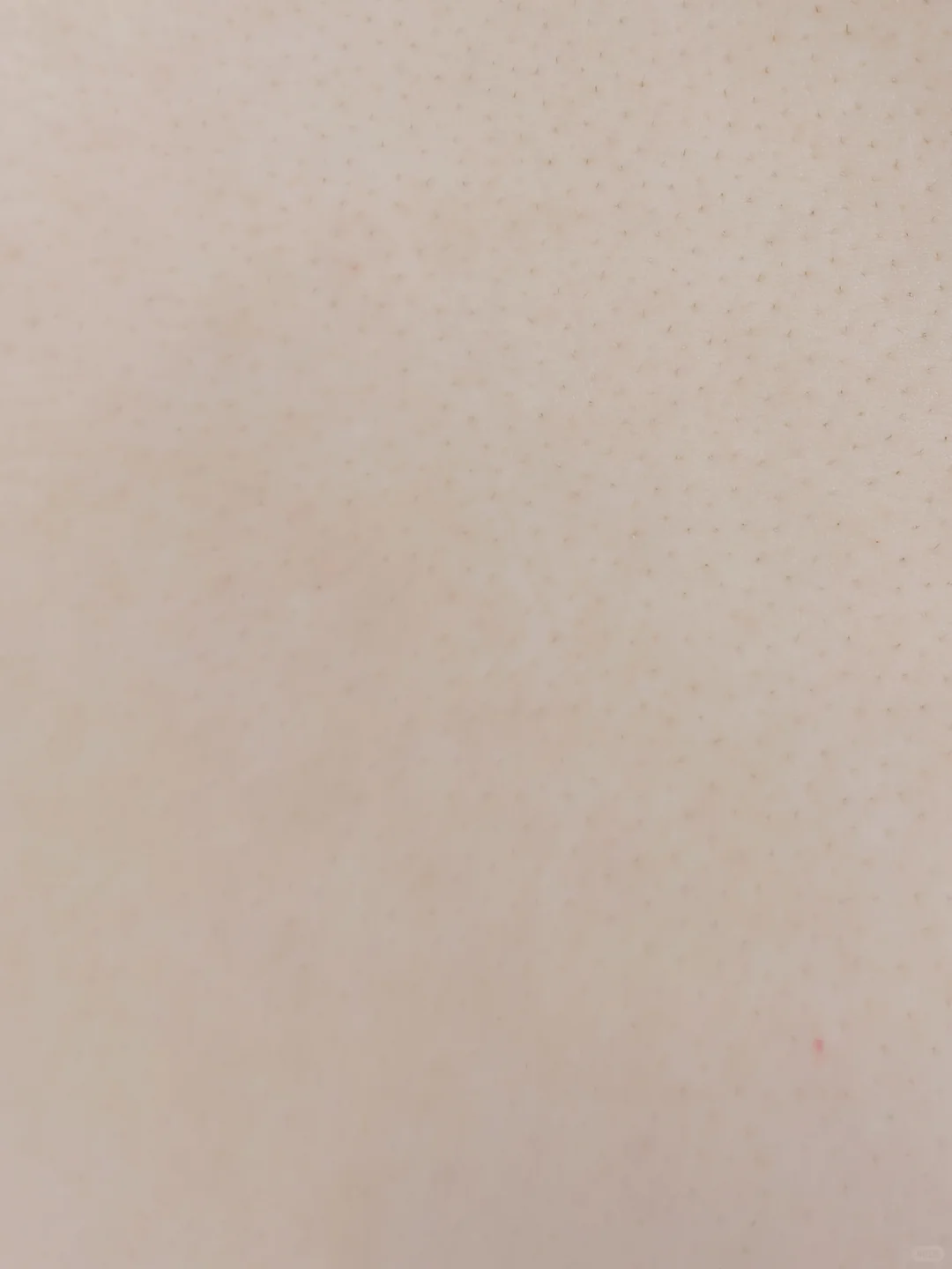 脱毛仪打卡Day32