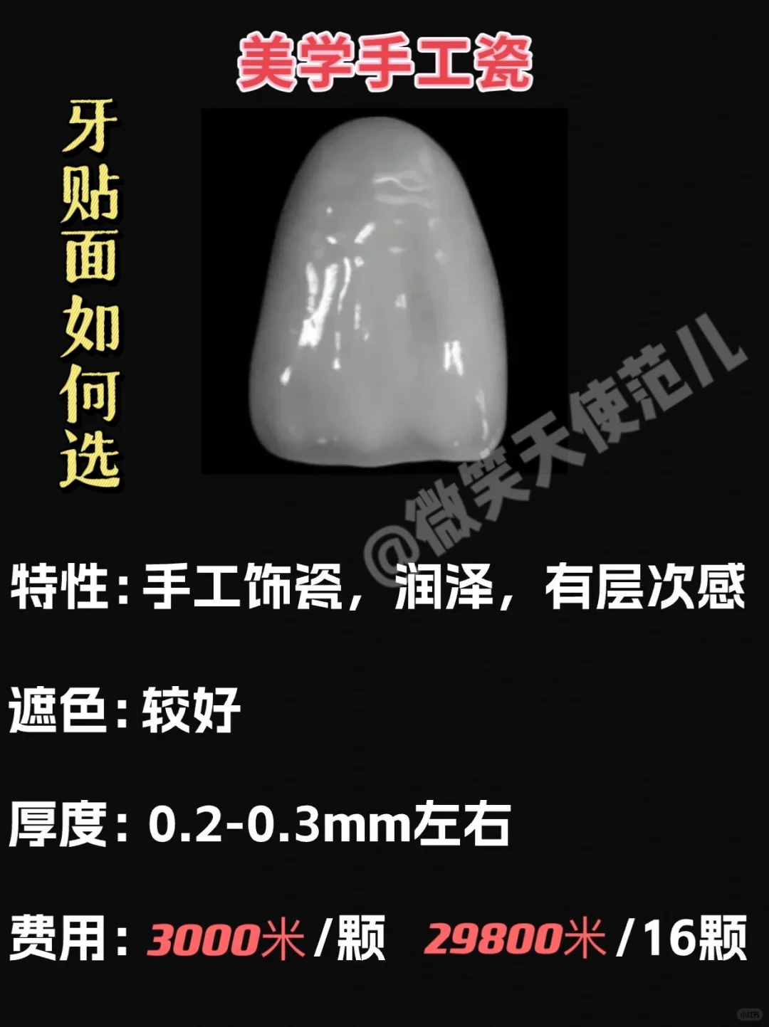 全瓷贴面都是有哪几种?