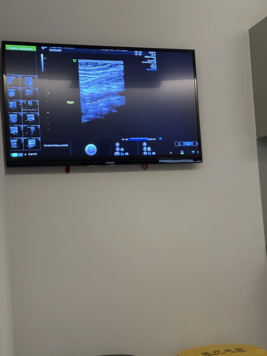 30+宝妈的二胎孕检实录