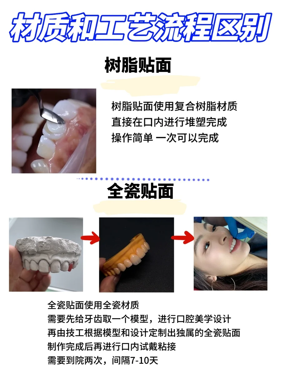 树脂贴面和全瓷贴面的区别在哪❓