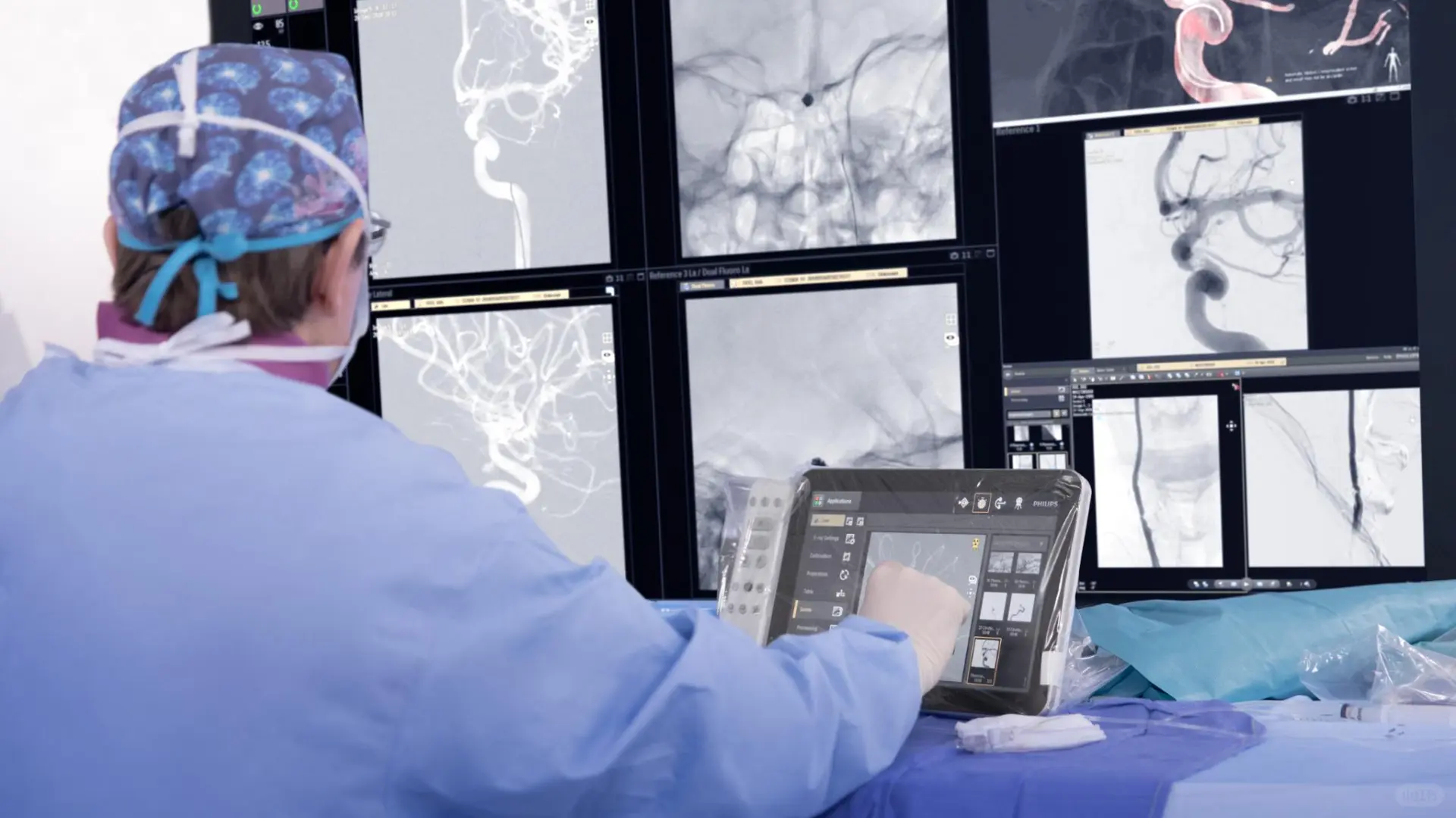 2025IF金奖，Philips神经手术双C臂设计