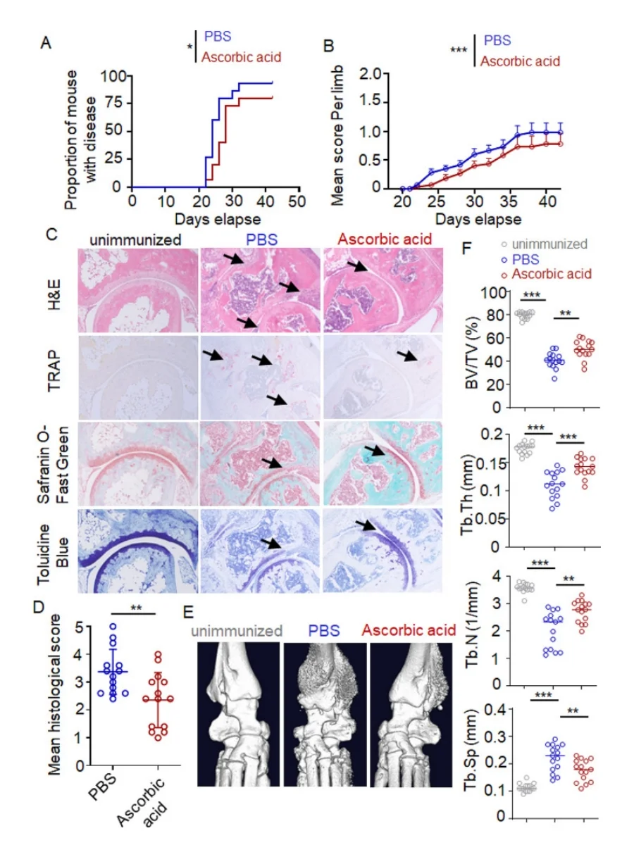 009维生素C缓解类风湿性关节炎的相关研究