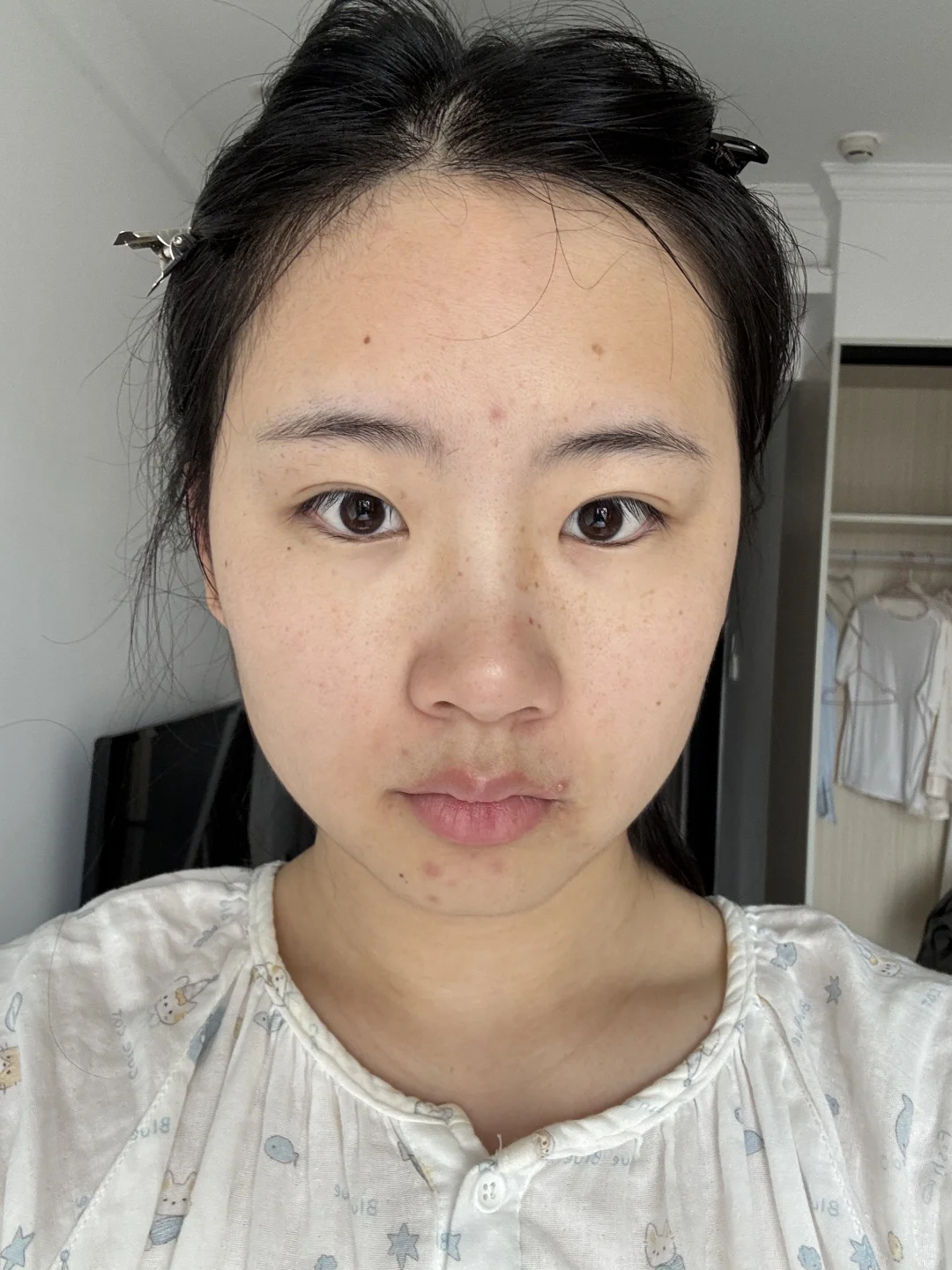 用了20天好像是亮了点？