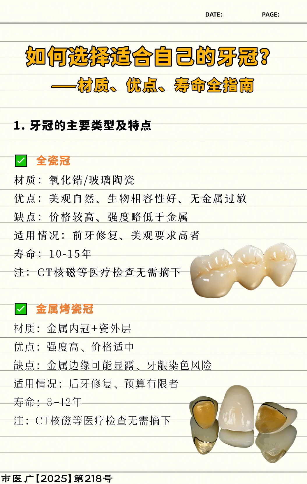 ✨牙冠怎么选？看这一篇就够了！西安种牙