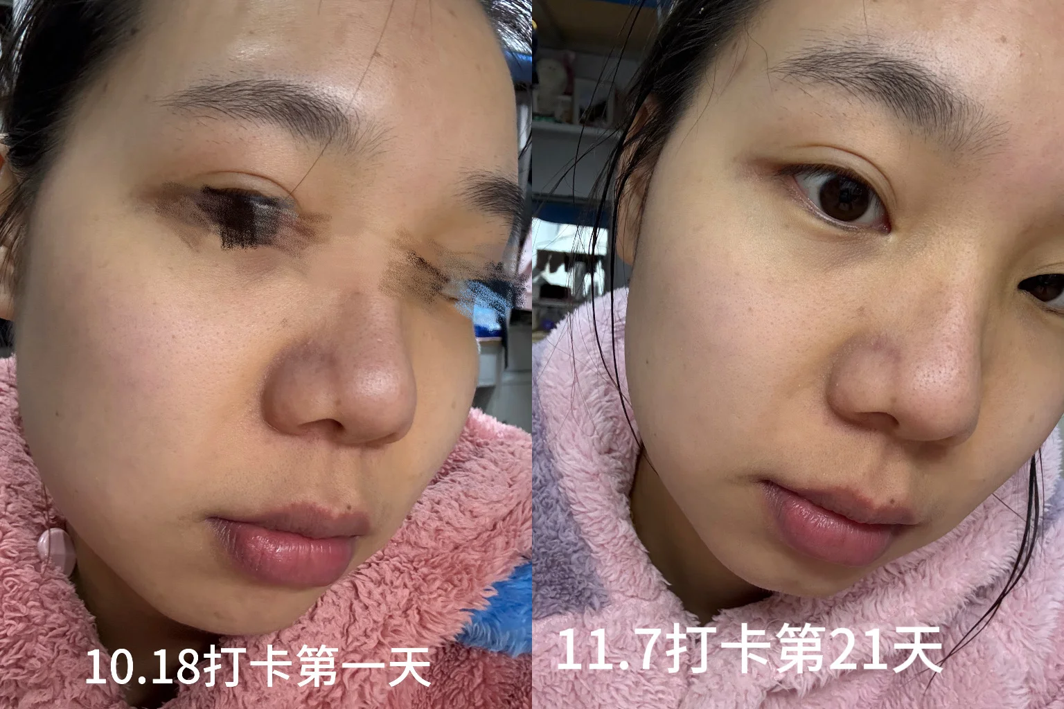 女大学生的护肤日记、坚持打卡酸c护肤