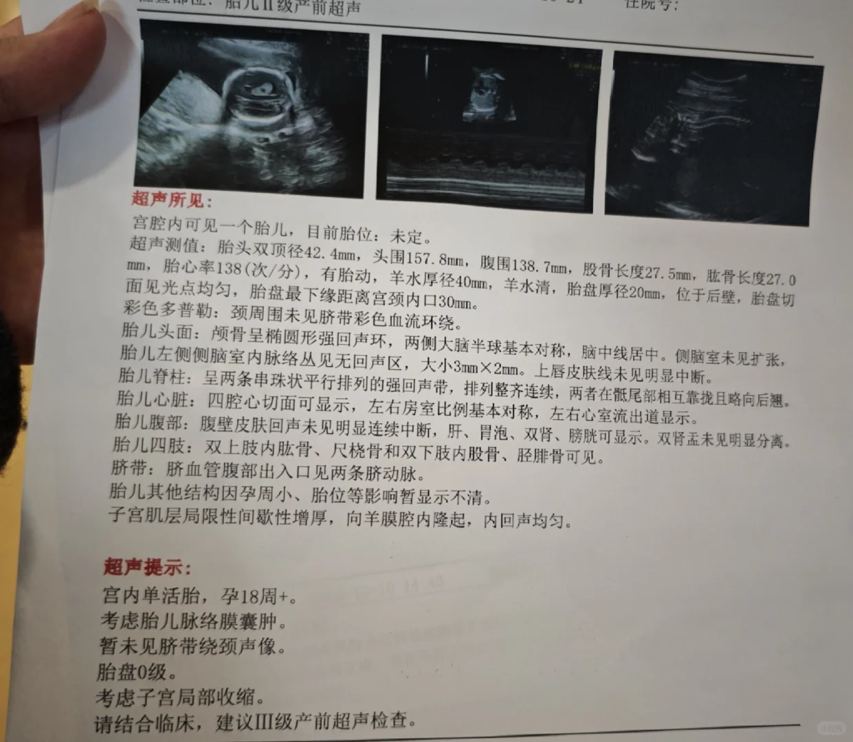 孕20周宫缩住院保胎 | 主播双十一的代价