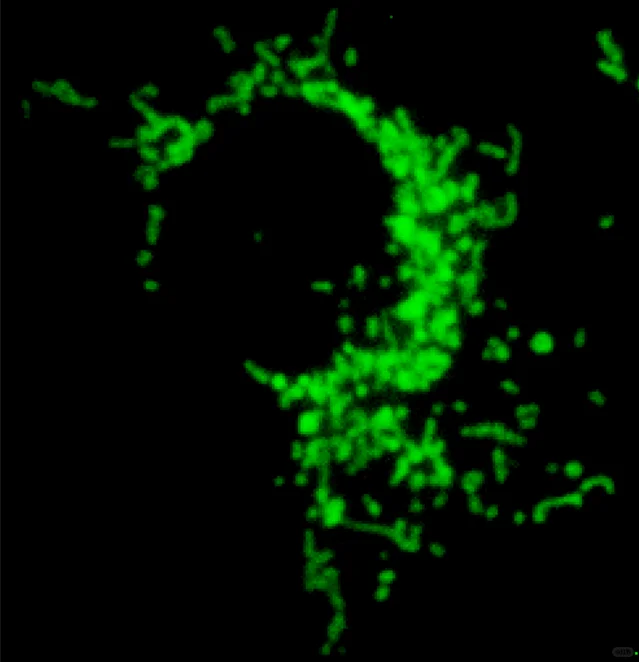 智能荧光显微分析仪能否PK共聚焦显微镜?!