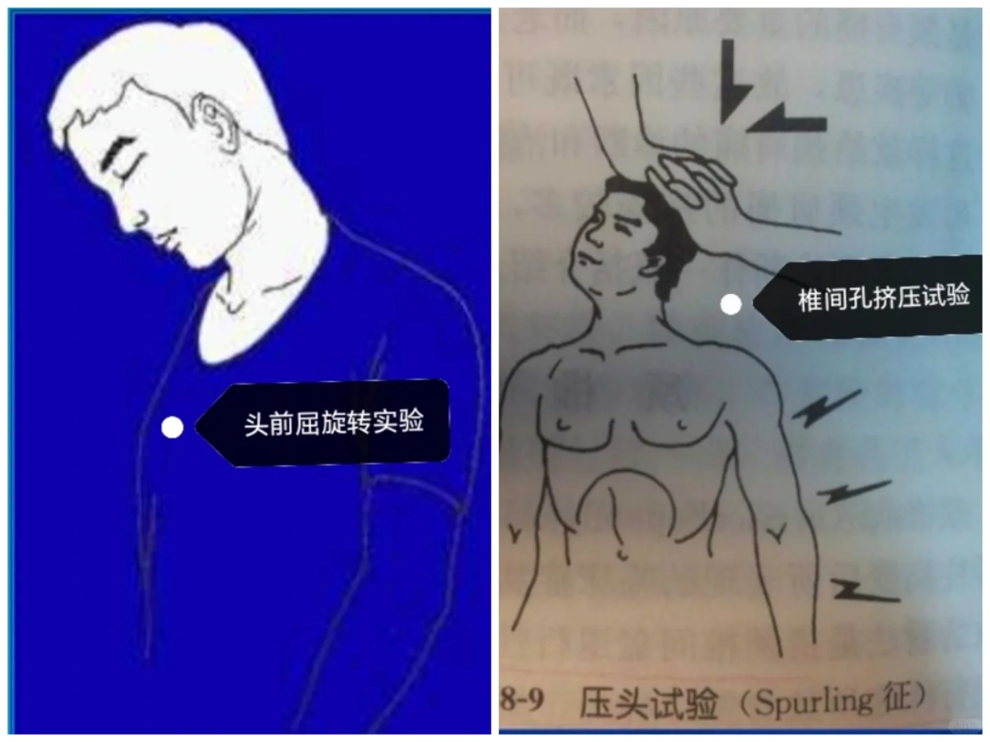 特殊检查相关试验