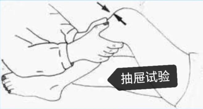 特殊检查相关试验