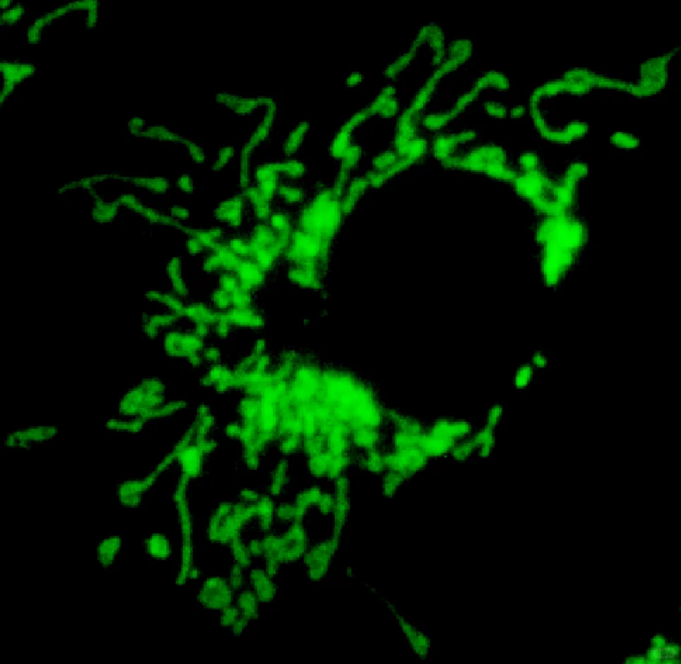 智能荧光显微分析仪能否PK共聚焦显微镜?!