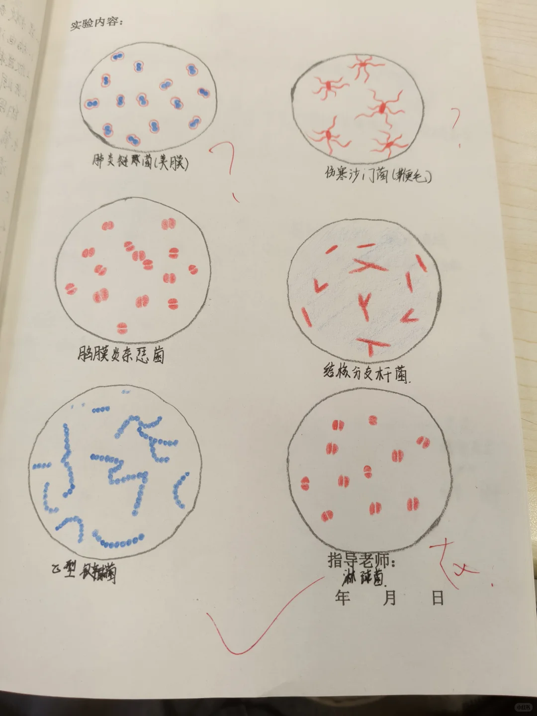 革兰染色与标本观察实验报告
