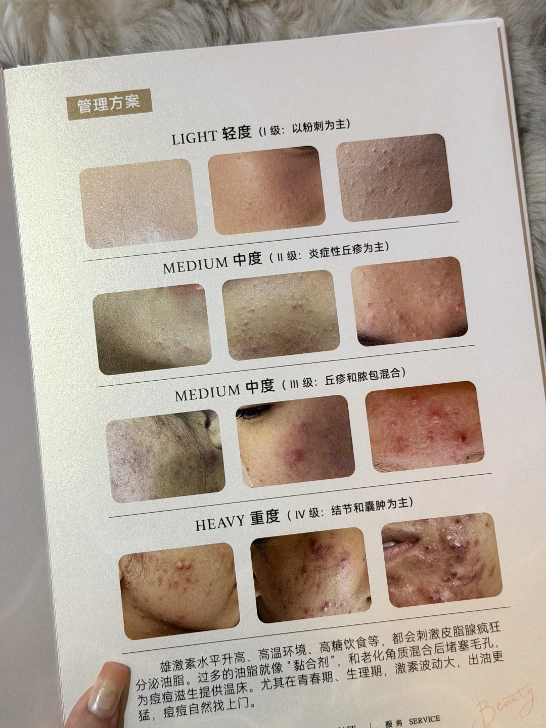 因为一本书爱上护肤…