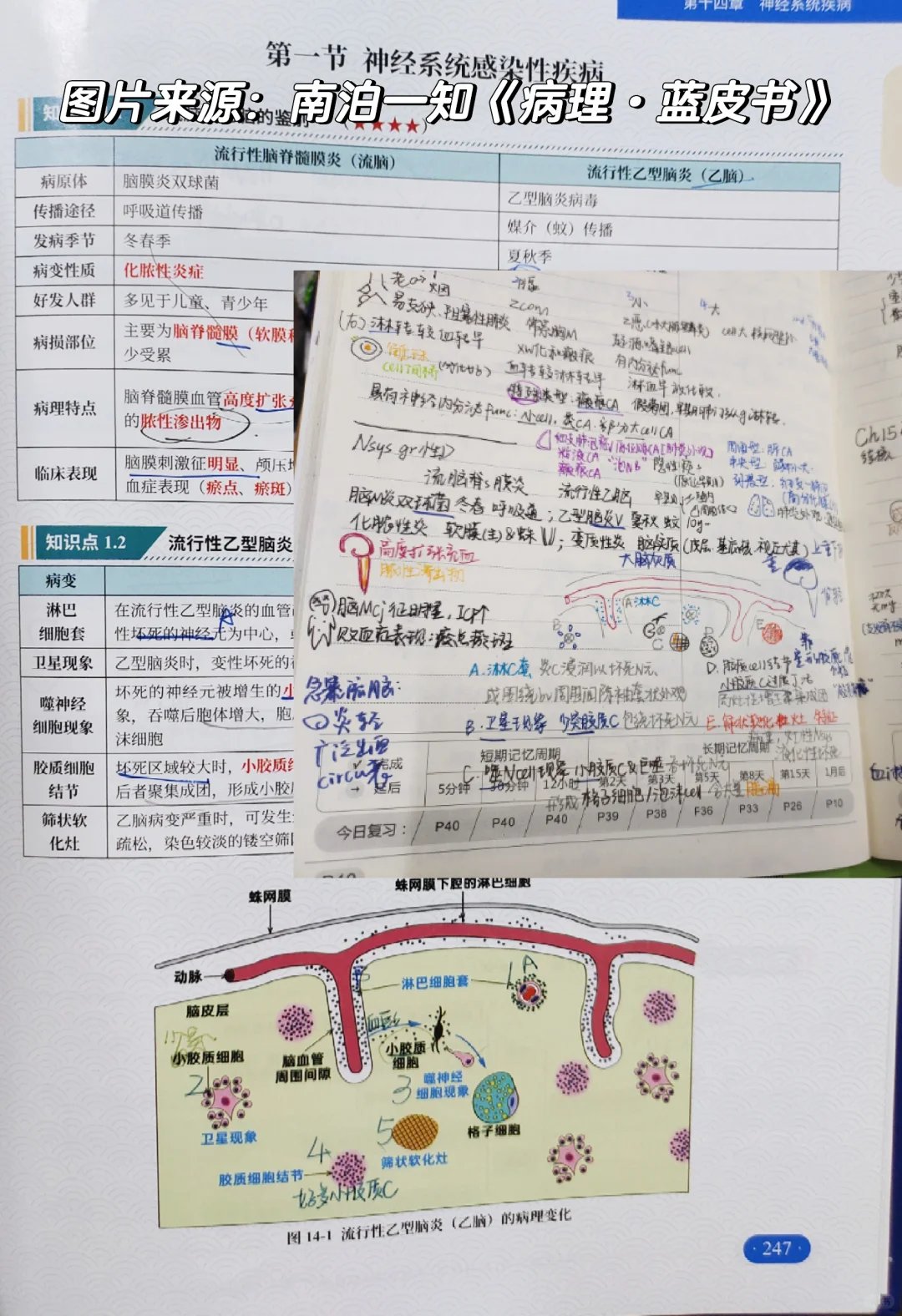 西综266：正式介绍我的真正王炸