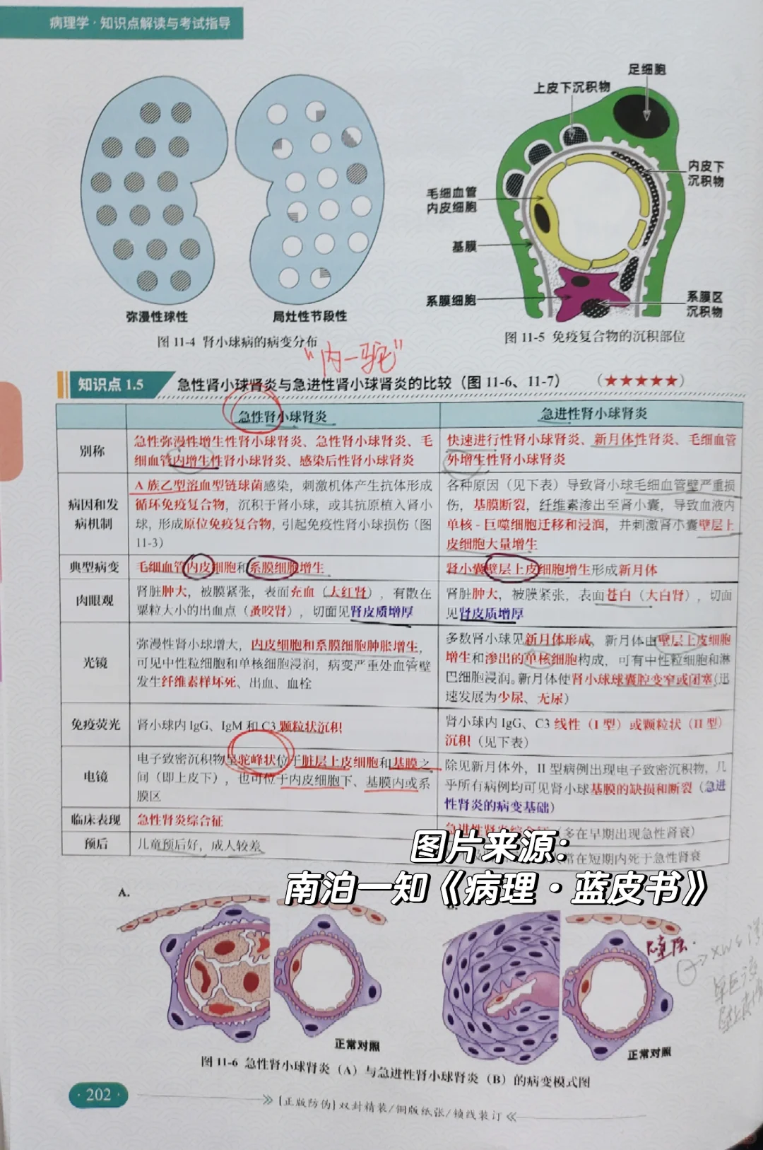 西综266：正式介绍我的真正王炸